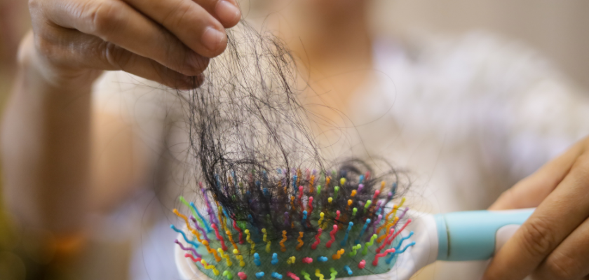 Concerned woman holding broken hair strands in her hands, showing signs of hair fall during monsoon season – VivaVel Hair Care Guide
